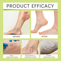 Natural Soothing Joint Cream – Fast-Absorbing Relief for Back, Hands & Feet (2-Pack)